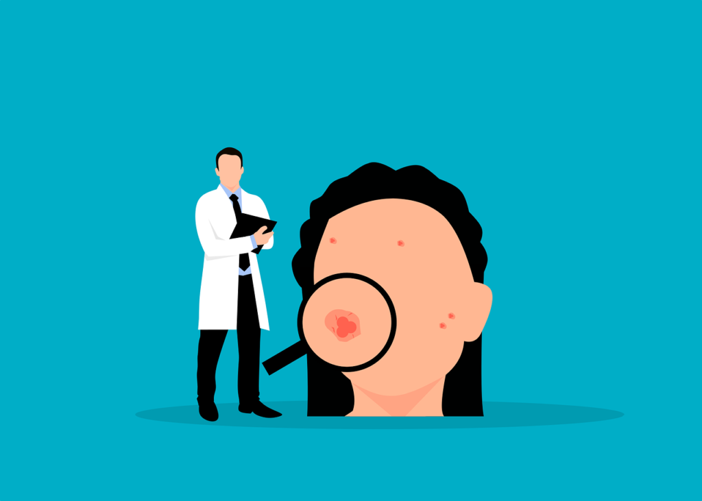 Dessein représentant une femme ayant de l'acné en présence d'un médecin en blouse blanche
