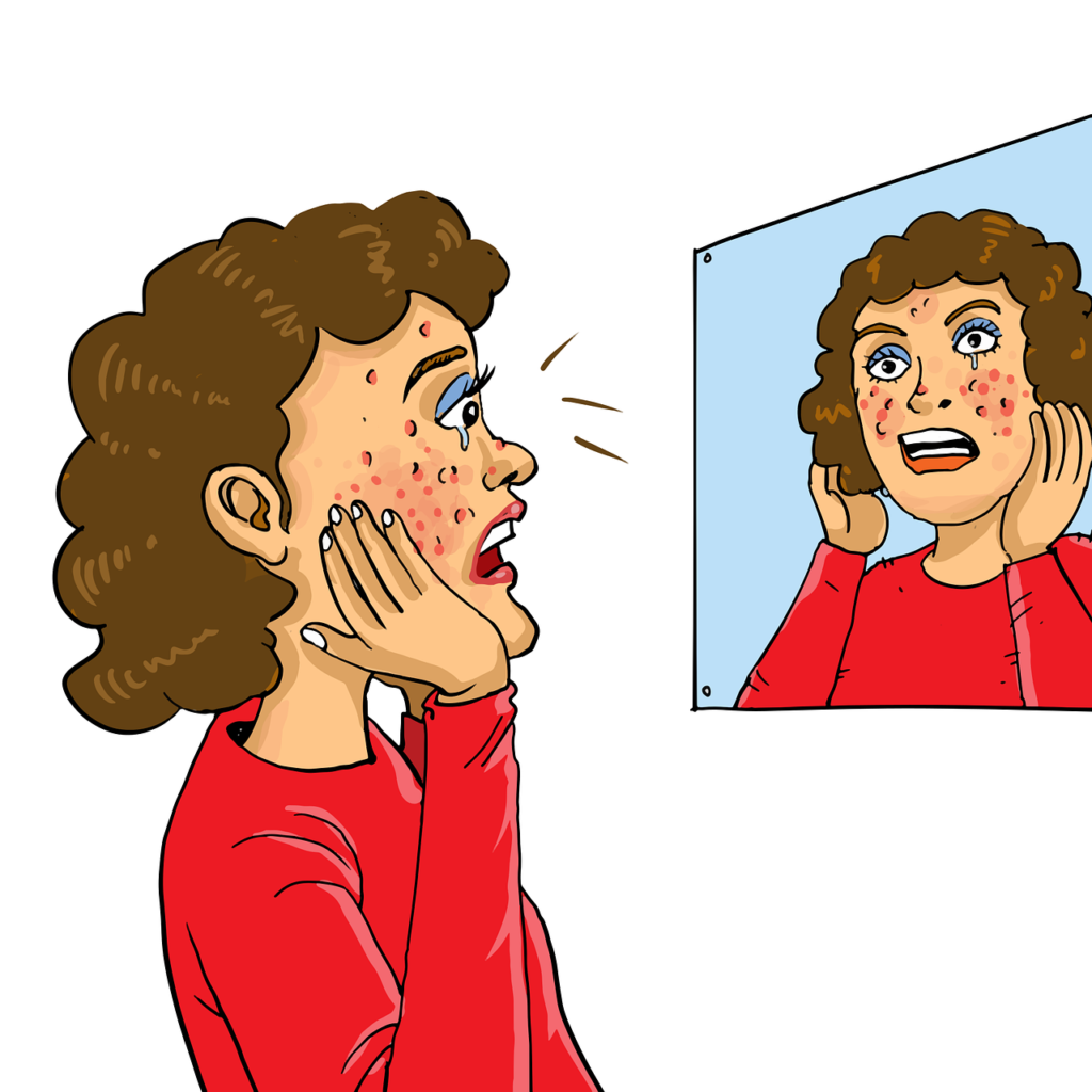 Illustration d'une femme ayant de l'acné